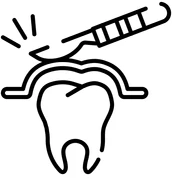 Oral Surgery Billing